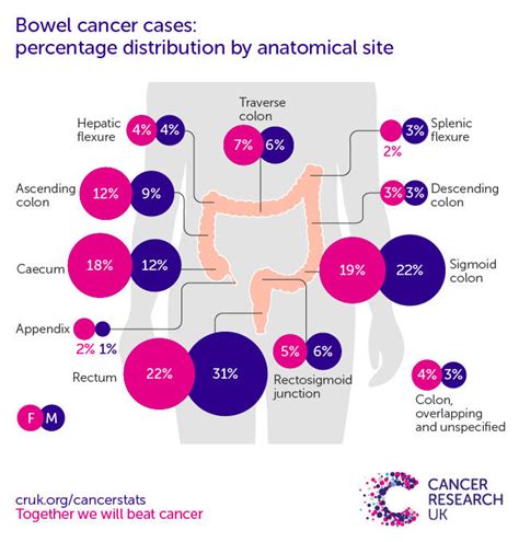 Bowel Cancer Incidence Statistics Cancer Research Uk