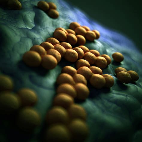 Different varieties of staphylococcus aureus bacteria, commonly called staph, exist. New Test Could Save Valuable Time When Diagnosing MRSA