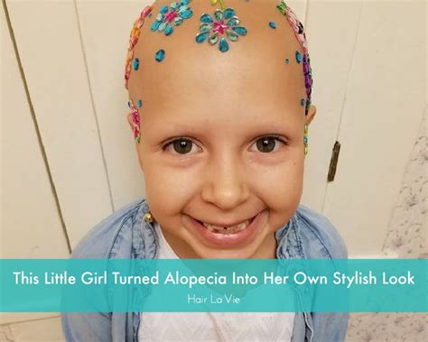 Adorable Girl With Alopecia Rocks Her Hairless Style At School Hair