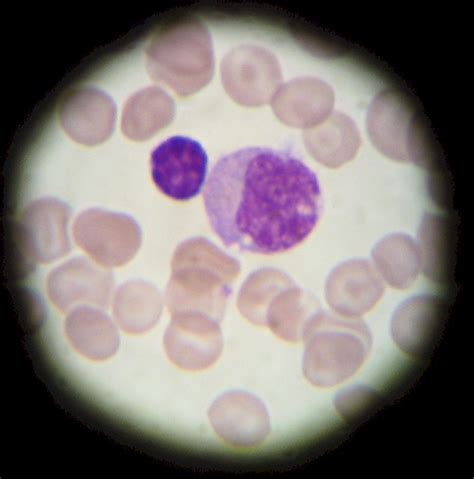 White Blood Cells Lymphocyte And Monocyte Two Types Of Whi Flickr