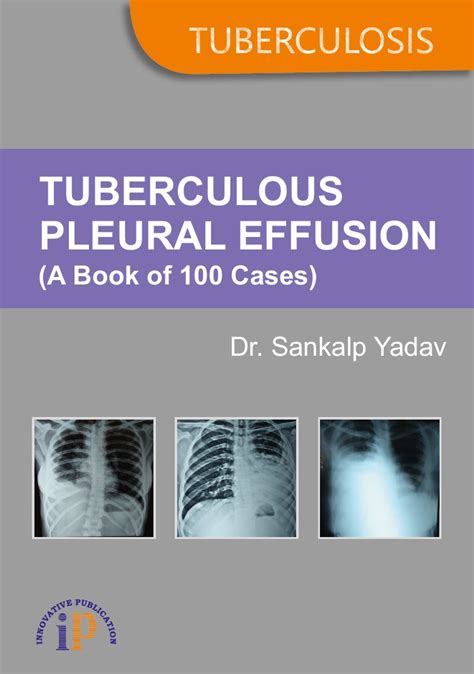 Tuberculous Pleural Effusion A Book Of 100 Cases