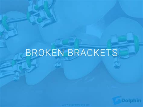 Broken Brackets Heights Orthodontics