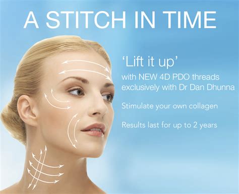 Pdo Thread Lifts The Instant Non Surgical Facelift
