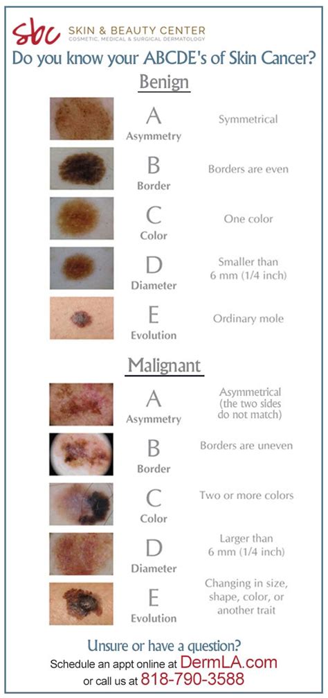 Know Your Abcs Of Skin Cancer