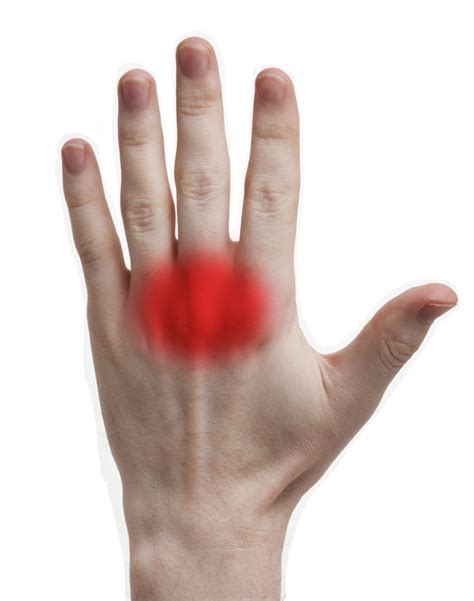 How To Approach Knuckle Pain In Gaming Based Off A Faq
