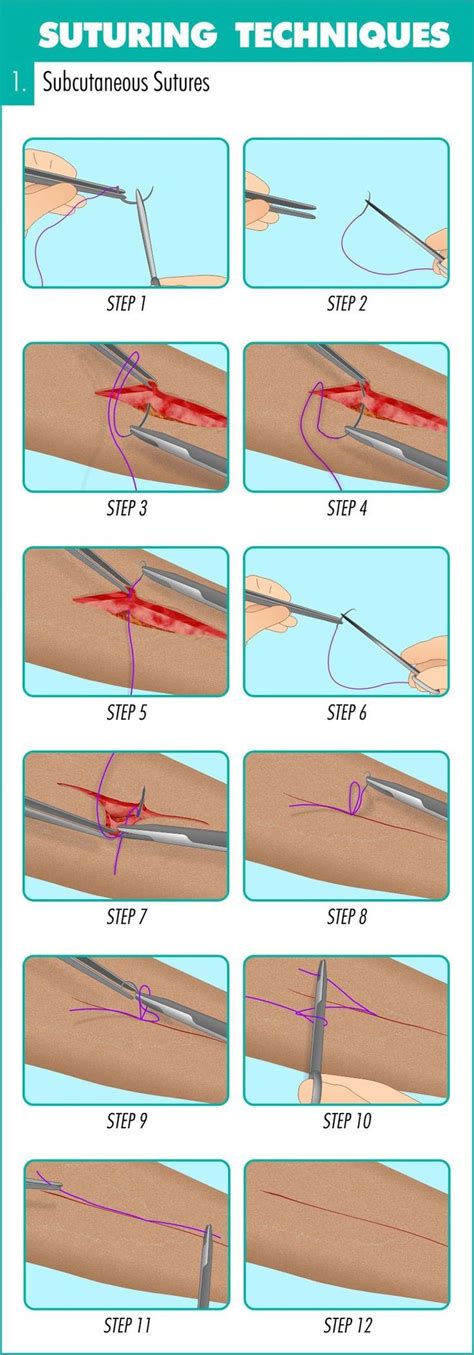 Surgical Suturing Techniques Mastery Guide The Apprentice Doctor
