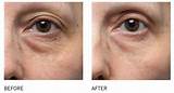 Images of Is Clinical C Eye Advance
