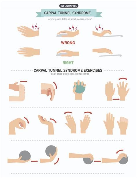 Understanding Carpal Tunnel Syndrome Symptoms And Prevention All