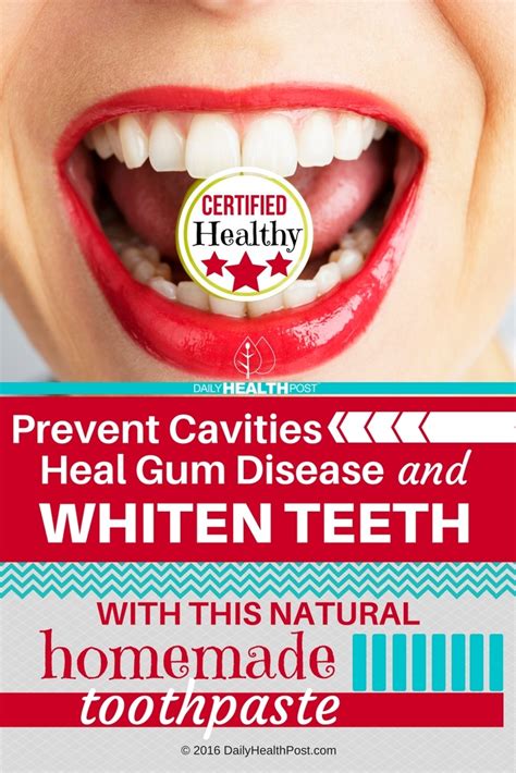 prevent cavities heal gum disease and whiten teeth with this natural homemade toothpaste