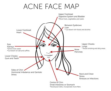 Acne Face Map In Traditional Chinese