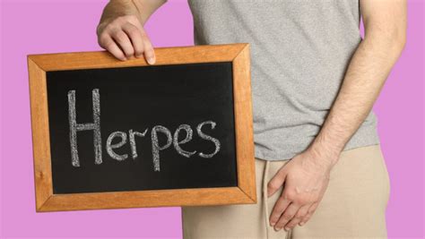 Genital Herpes A Guide To Symptoms And Treatments