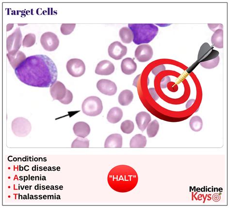 Target Cells Medicine Keys For Mrcps