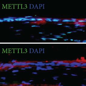 K14creER Mettl3fl Fl Mice And Cornea Damage Model Construction A