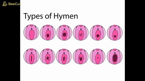 Hymen For Women S Health And More YouTube