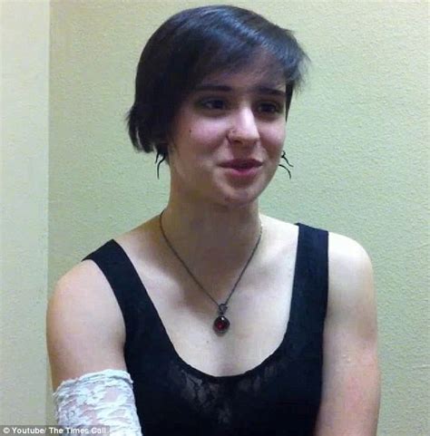 Anna Beninati Recalls Watching Her Legs Get Severed As She Tried To Jump On Train Daily Mail
