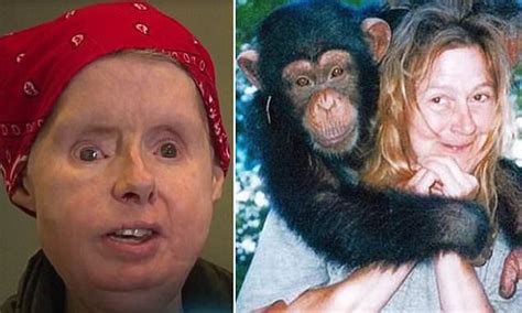 Chimpanzee Travis victim Charla Nash's body rejecting face transplant
