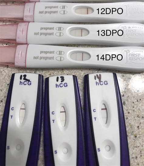 14dpo Frer Bfp After 6 Cps How Does This Progression Look R