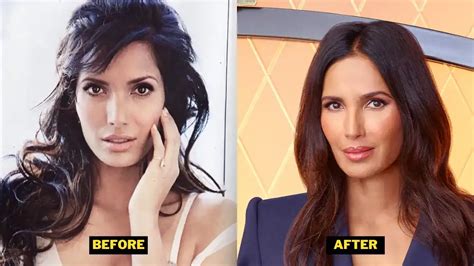 Padma Lakshmi Plastic Surgery Her Skin Routine Details With Before After Pics