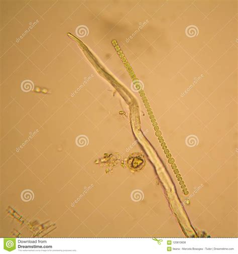 Nostoc Sp Algae Under Microscopic View Cyanobacteria Providing