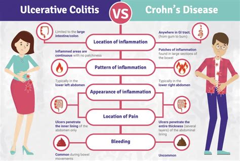 Understanding Inflammatory Bowel Disease Ibd What Is Crohns And