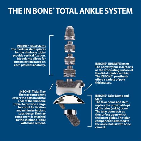Total Ankle Replacement Florida Orthopaedic Institute