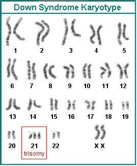 Human Chromosomal Abnormalities Autosomal Abnormalities