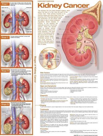 Anatomy Charts Posters Understanding Kidney Cancer Anatomical Chart