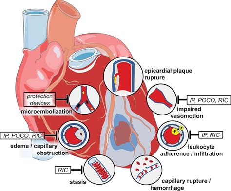 The Coronary Circulation As A Target Of Cardioprotection Circulation