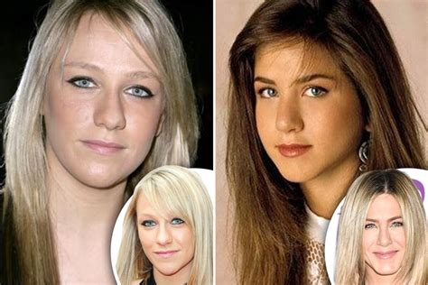 Rhinoplasty Before And After Which Celebs Have Had Nose Jobs From