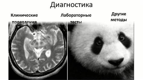 Болезнь Вильсона-Коновалова - YouTube Картинка - Болезнь Вильсона-Коновалова - YouTube