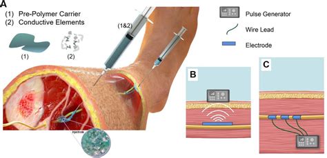 A Truly Injectable Neural Stimulation Electrode Made From An In Body