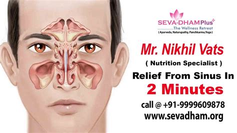 Relief From Sinus And Migraine In 2 Minutes By Nikhil Vats Seva