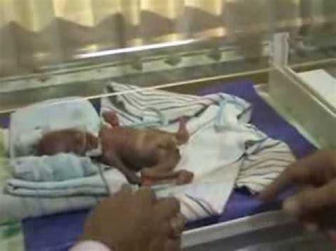 Sebenarnya, demam bukanlah penyakit, tetapi kesan penyakit. Suhu Normal Bayi Baru Lahir | 97 Bayi dan Anak