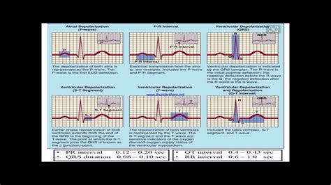 Life In The Fast Lane Ekg Practice