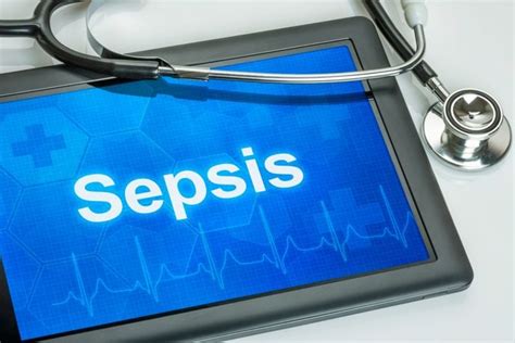 Sepsis Facty Health