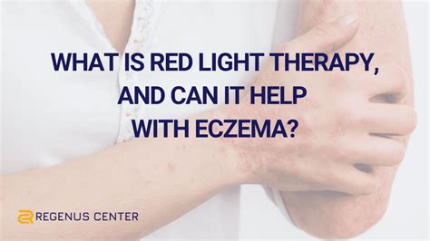 What Is Red Light Therapy And Can It Help With Eczema Regenus Center