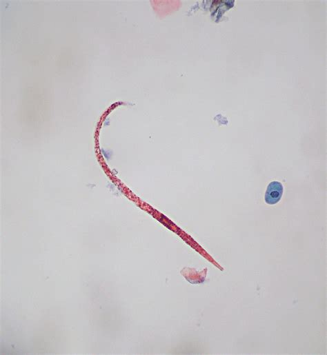 Worm In Wee Wee Urine Specimen With A Worm Hookworm Mayb Flickr