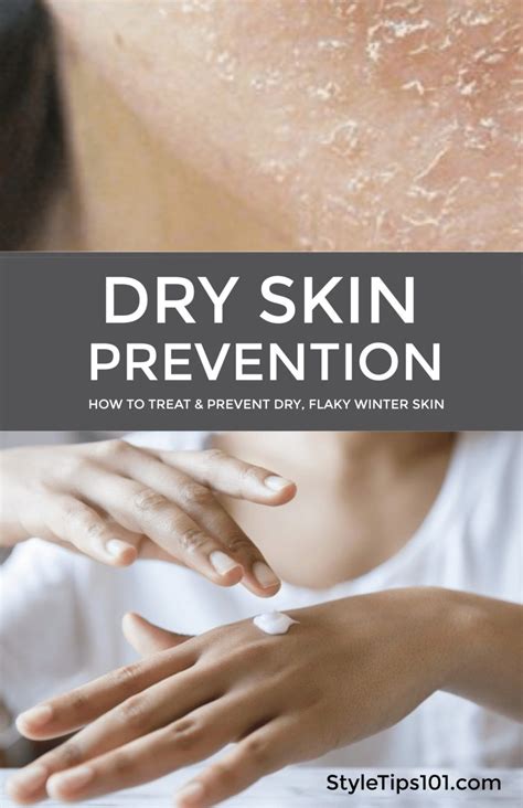Dry Skin Prevention Dryskin Preventdryskin Styletips101 Dry Skin