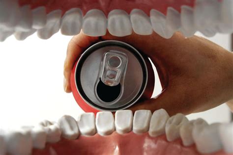 Effects Of Drinking Soda On Your Teeth Dental Implants In Dubai