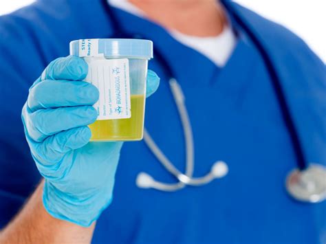 A blood sample will be drawn to serve as the baseline of your glucose level. Urine Glucose Test: Purpose, Procedure, and Results