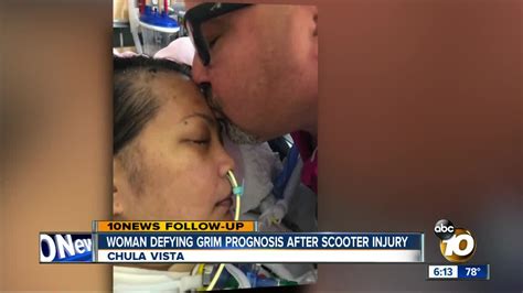 Chula Vista Mom Defying Grim Prognosis After Scooter Accident