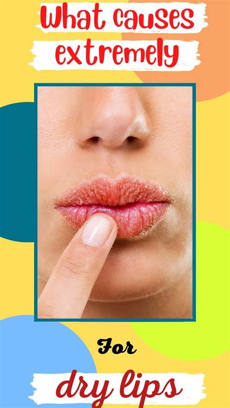 Vitamin Deficiency For Dry Lips Symptoms Causes And Treatments In
