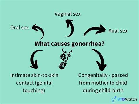 Gonorrhea Everything You Need To Know