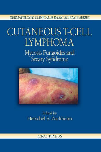 Cutaneous T Cell Lymphoma Mycosis Fungoides And Sezary Syndrome Crc