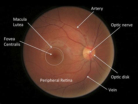 Anatomy - Ocular Manifestations Of Systemic Disease