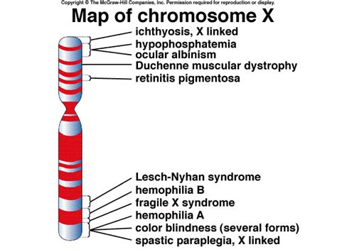 Map Of Chromosome X Ichthyosis Duchenne Muscular Dystrophy Chromosome