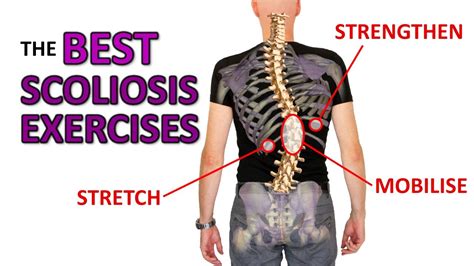 The Best Exercises For Scoliosis Youtube