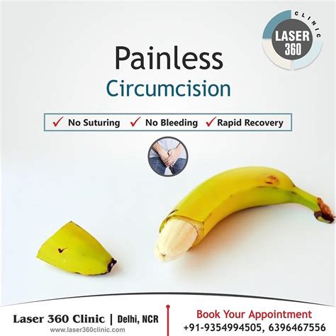 Avail Painless Circumcision Laser Treatment At Laser 360 Clinic