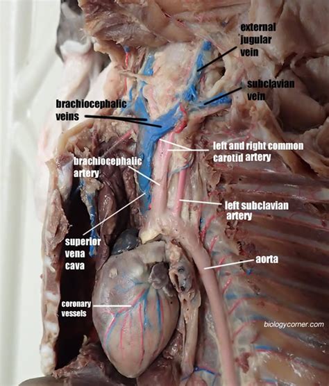 You've got the right brachiocephalic vein and the left brachiocephalic vein. Cat Vessels Image Gallery