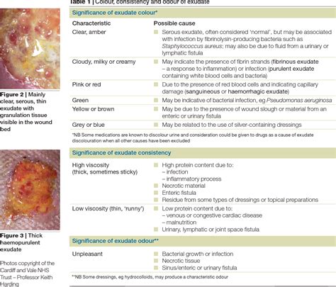 Figure 4 From Wound Exudate And The Role Of Dressings A Consensus